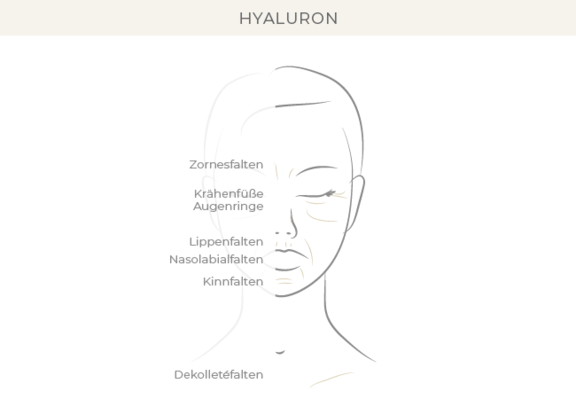hyaluron-bonn-dr-eugenia-remmel.png